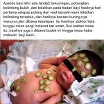 Betul ke Belimbing Buloh adalah Rawatan efektif baby kuning atau jaundice ??