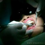 Klinik Pergigian Erfa Wangsa Melawati Best Terbaik