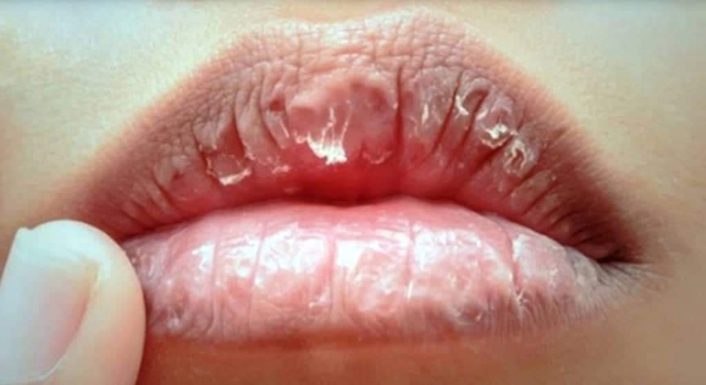 Lip Balm NUUR SUCHI merawat Bibir Kering